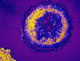 Virus